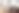 Enlarge the image